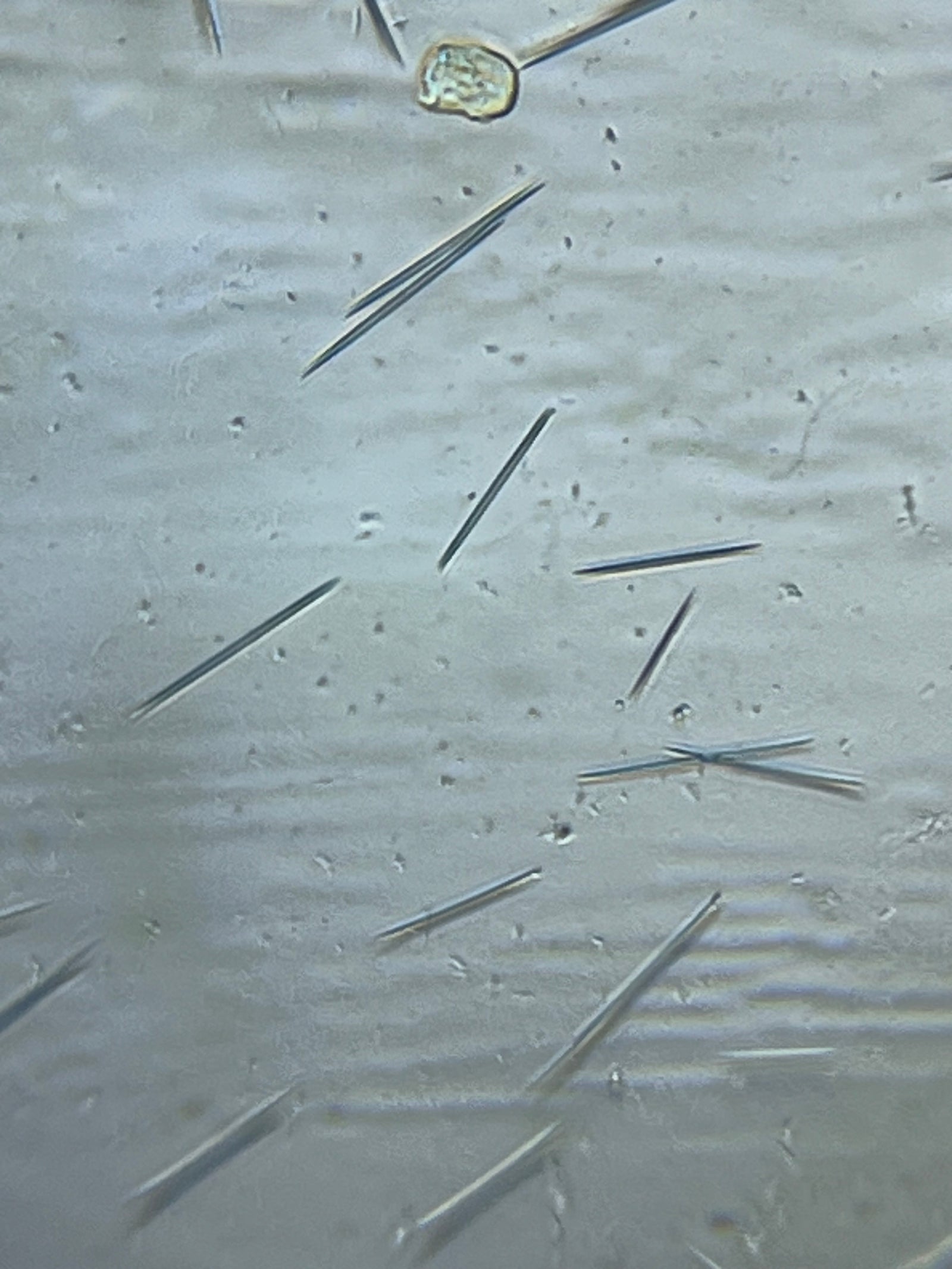 Foldscope Explores… Pineapple Needles!