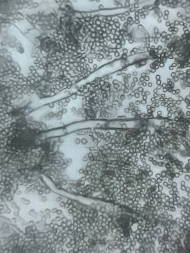 Foldscope Explores… Mold!