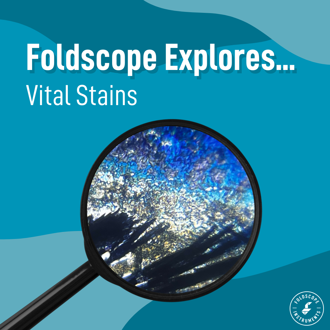 Foldscope Explores... Vital Stains (Part 1)