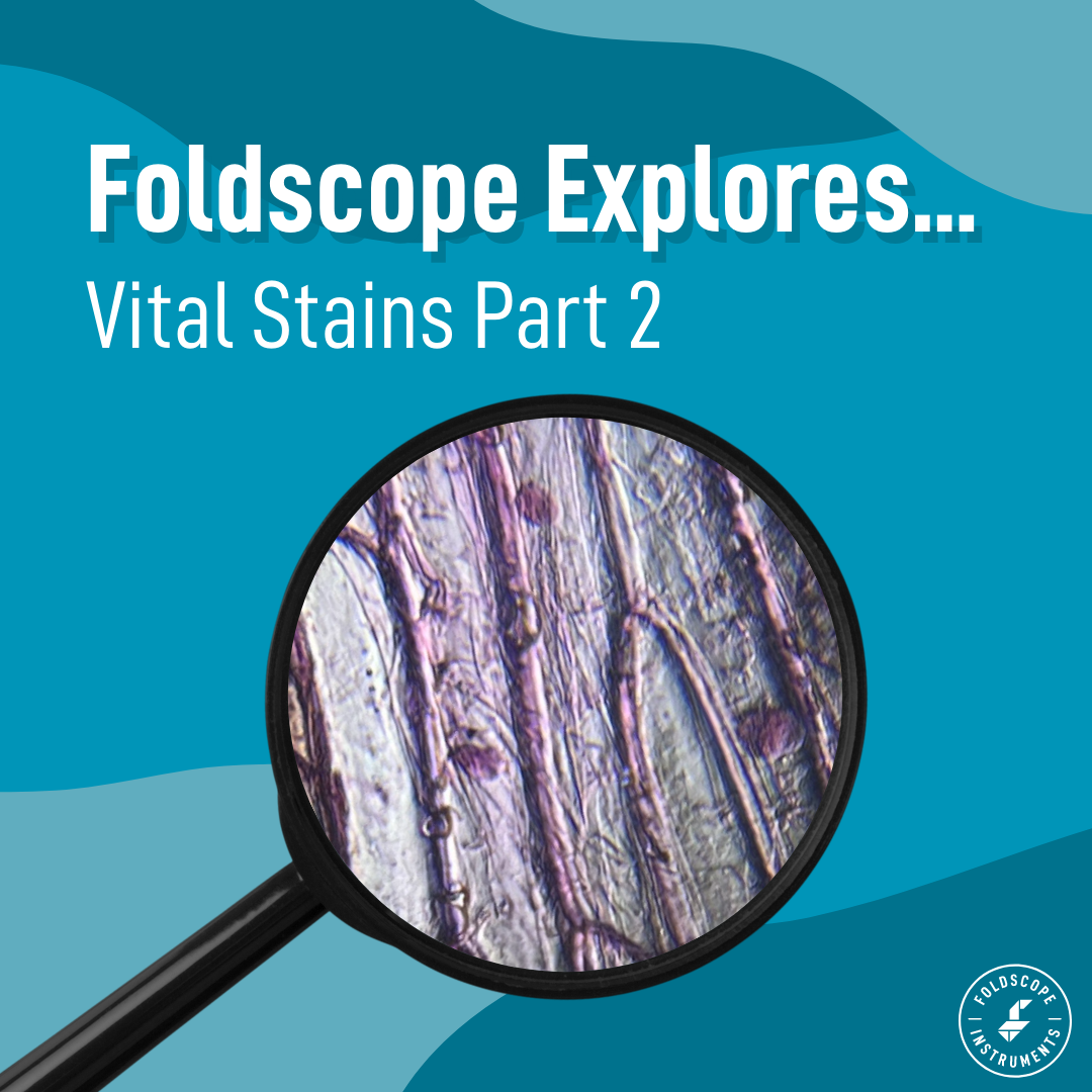 Foldscope Explores... Vital Stains (Part 2)
